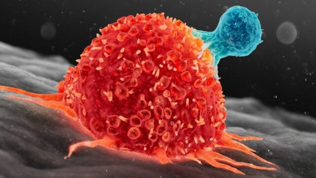 A 3-Year-Old's Metastatic Cancer Disappeared After Two Doses of Experimental Therapy