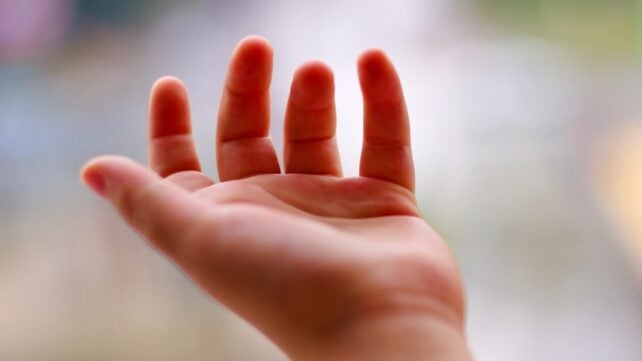 Cerebral Palsy Might Not Actually Be a Disease, Scientists Say