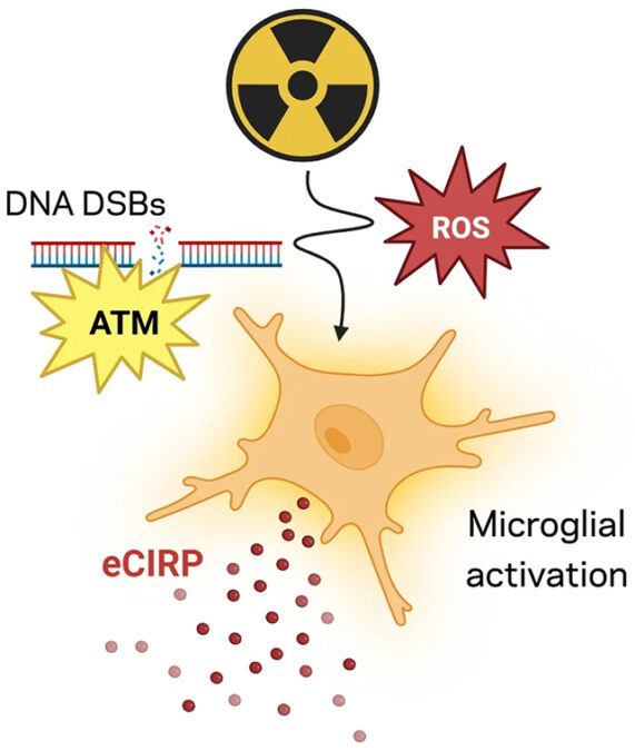 Radiation exposure