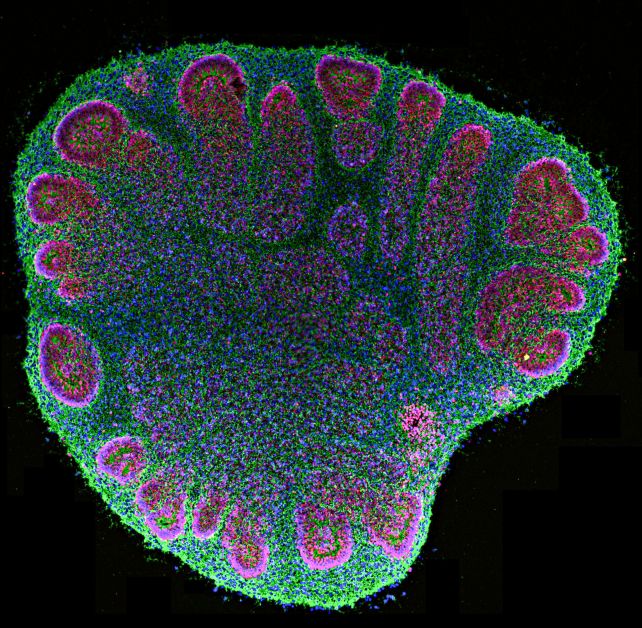 Scientists Connected Human Mini-Brains in a Dish. They Learned to Sense Each Other's Signals