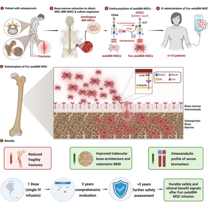 Scientists Modified Patients' Stem Cells, And It May Have Reversed Their Osteoporosis