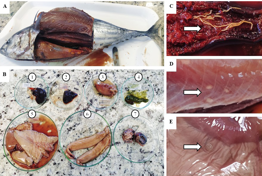 Scientists Find Parasites Swimming in 96 Percent of a Tuna Fish Sample