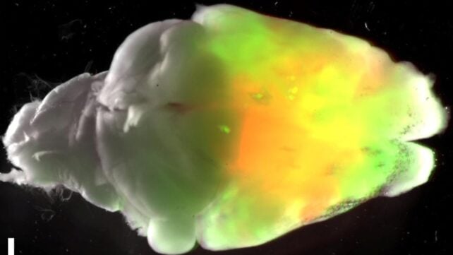 Scientists Grew Human Brain Tissue Inside Mice. Here's What Happened.