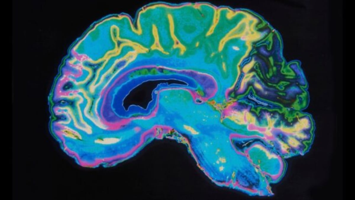 The female brain does something unexpected in the transition to menopause.