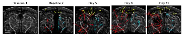 New Ultrasound Technique Lets Scientists Watch Deadly Cancer Make a Nest in The Brain