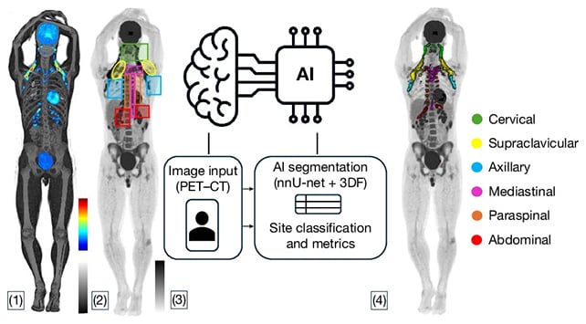 AI fat scans