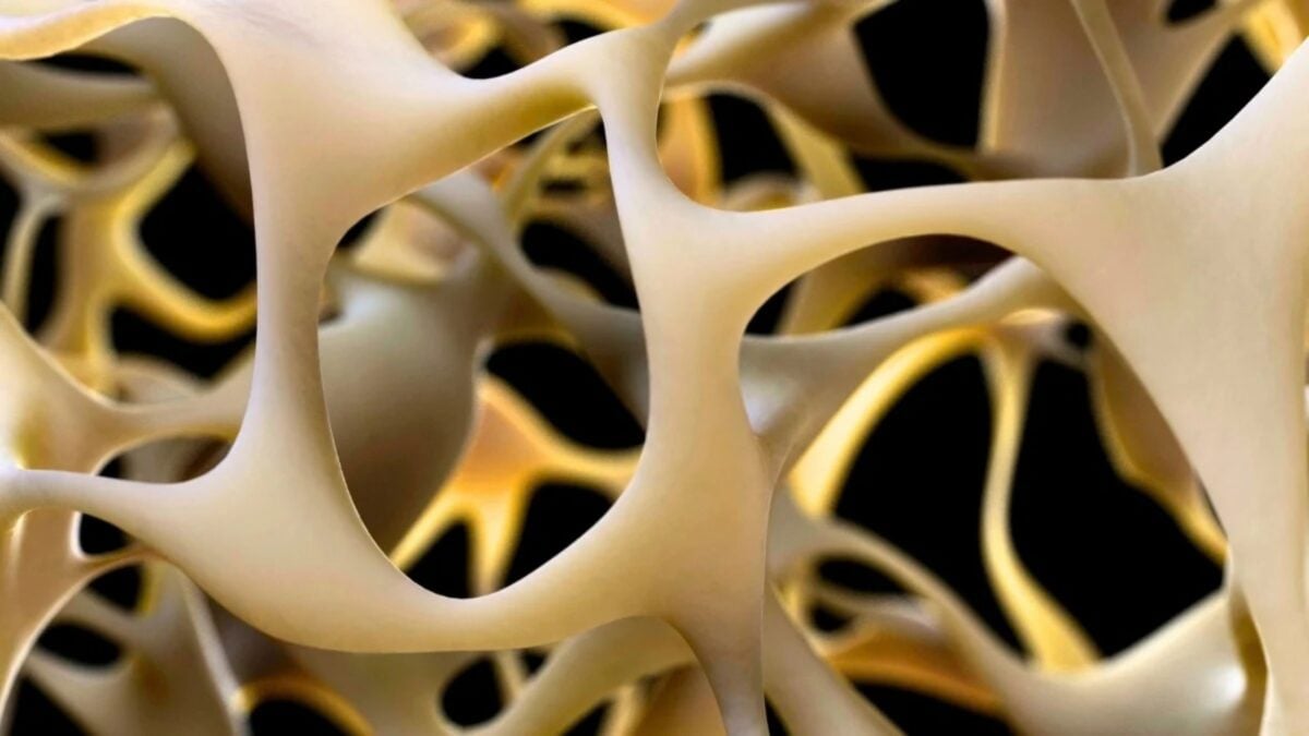 High Blood Pressure May Directly Accelerate Osteoarthritis