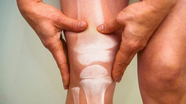 Weaker Bones Have Been Linked to Faster Brain Aging in a New Study
