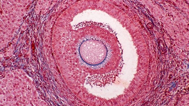 Mounting Evidence Shows a Common Plastic Chemical Can Affect Human Ovaries