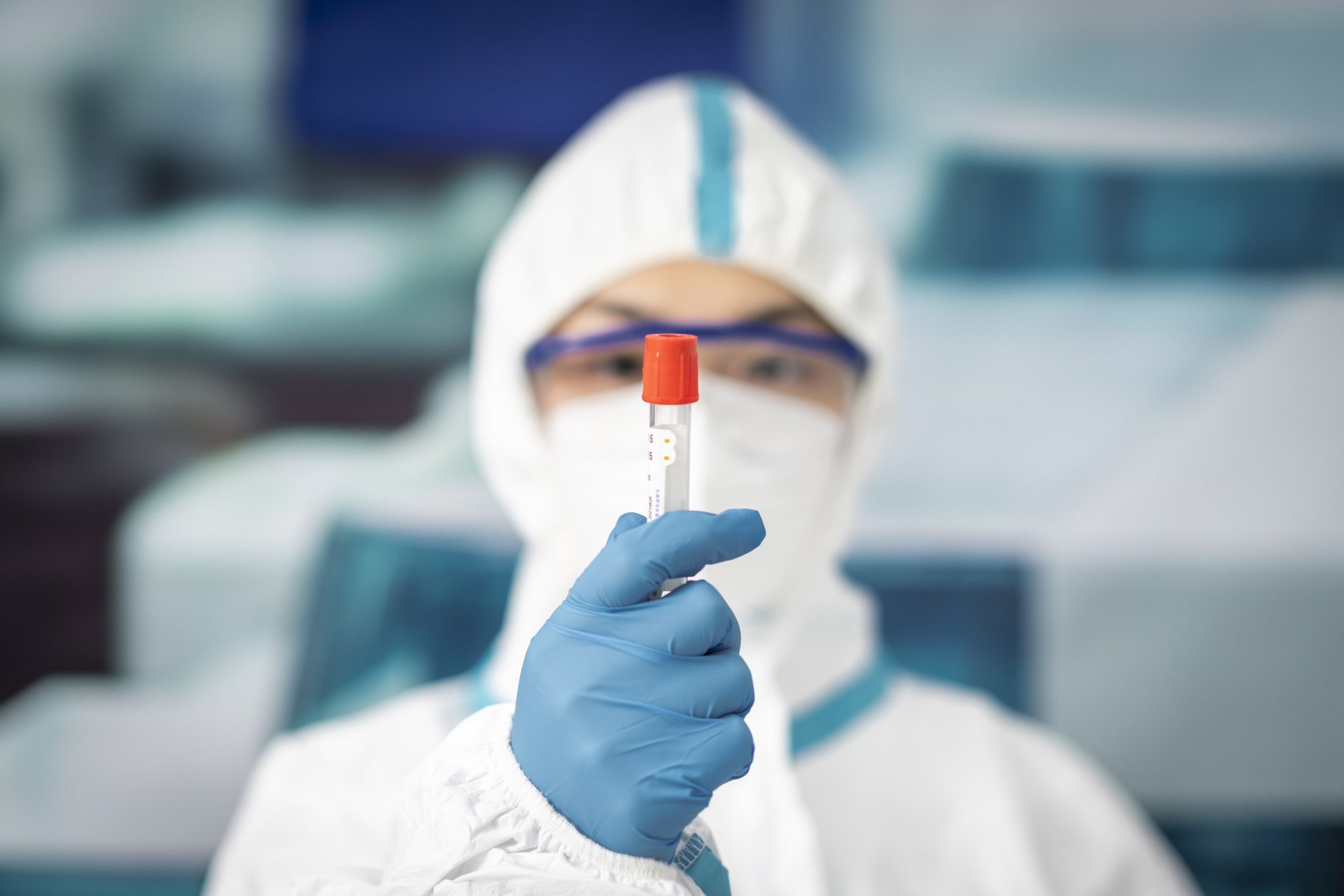 Should We Be Worried About a Russian 'Plague Epidemic'? Scientists ...