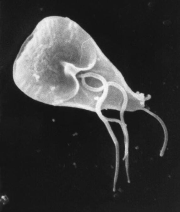 There's Another Cat Parasite That Can Infect Humans. A Huge Study Reveals How Common It Is.