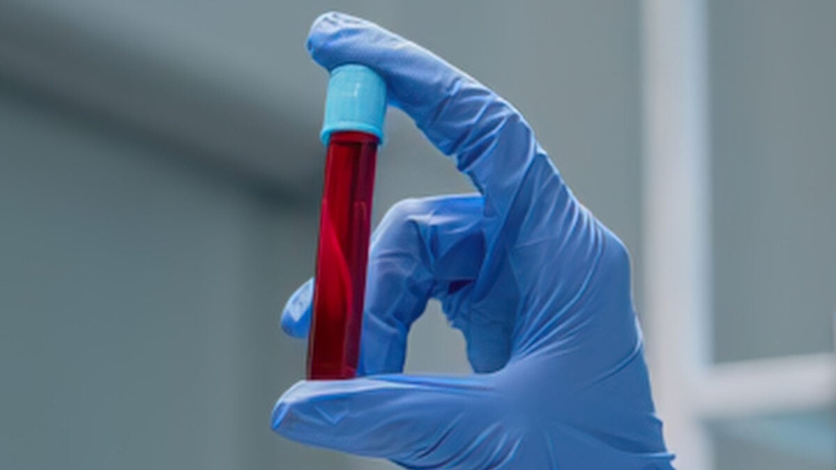 Scientist holding red blood sample tube in lab