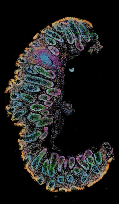 A curved section of intestinal tissue mapped in multiple colors against a black background.