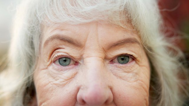 LASIK Alternative Promises to Improve Vision Without Scalpel or Lasers
