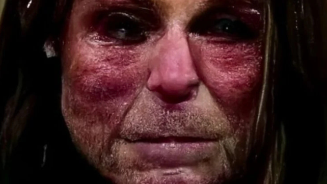 The Eerie True Story of The Nightmare Face Haunting The Internet