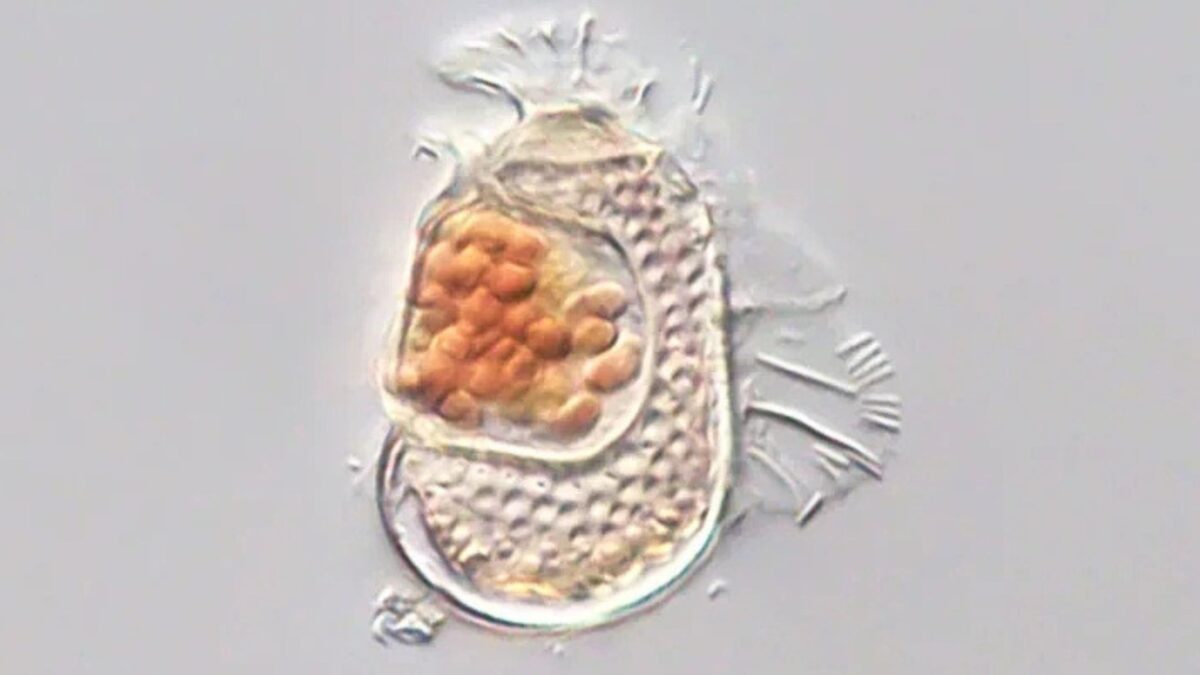 Microbe Discovered With One of The Smallest Genomes on Record, Pushing The Bounds of What It Means to Be Alive