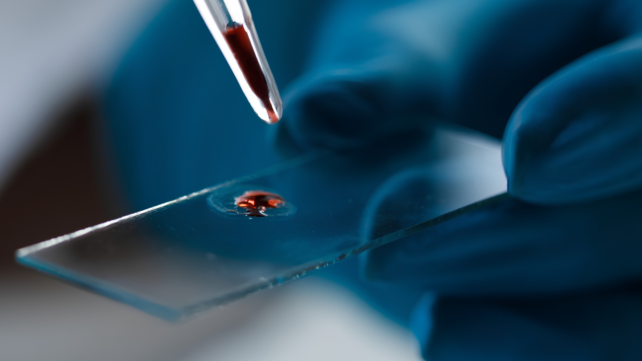 Researchers Developed a Molecule to Fight Alzheimer's &ndash; Then Found It's Already in Our Blood