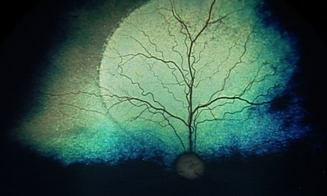 Dog retina
