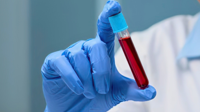 Scientists Found a Blood Signature Linked to 23% Lower Risk of Death