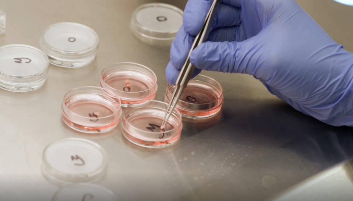 Ovaries Develop an Intriguing Second Role After Menopause