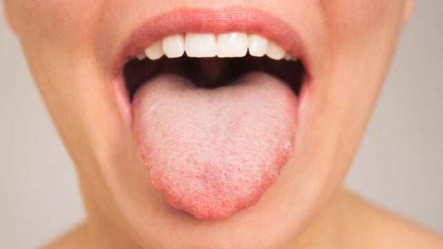 Your Mouth's Bacteria May Be Linked to How Quickly You Think