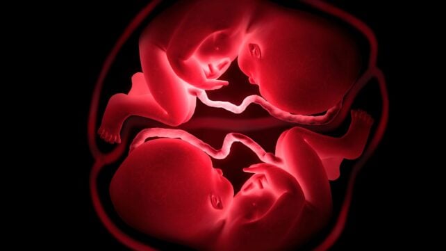 Scientists Trace How Cancer Passed Between Twins Before Birth