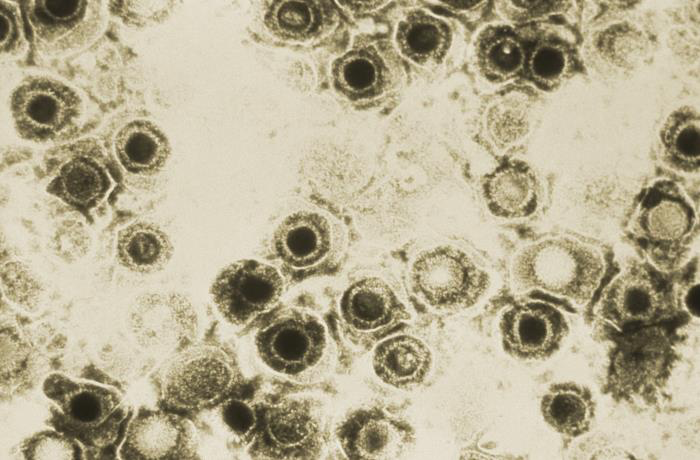 Herpes Virus Appears to Hijack The Brain's Immune Cells, And It Could Have Serious Consequences
