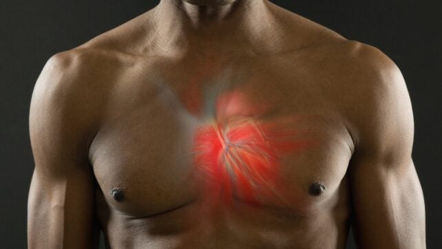 Both Low And High Testosterone Seem to Be Linked to an Irregular Heartbeat, Study Finds