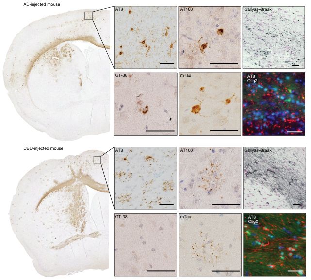 Scientists Watched Human Dementia Proteins Spread Through Mouse Brains Like Prions