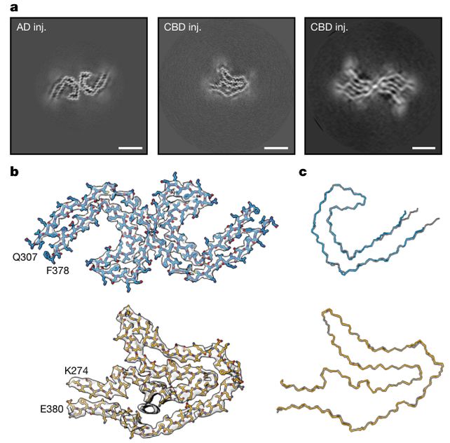 Scientists Watched Human Dementia Proteins Spread Through Mouse Brains Like Prions