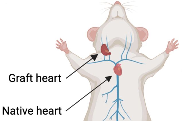 Old Hearts Become Biologically Younger When Transplanted Into Younger People