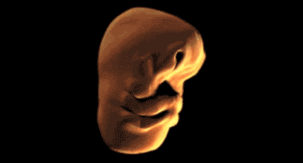 proses pembentukan wajah bayi dalam kandungan