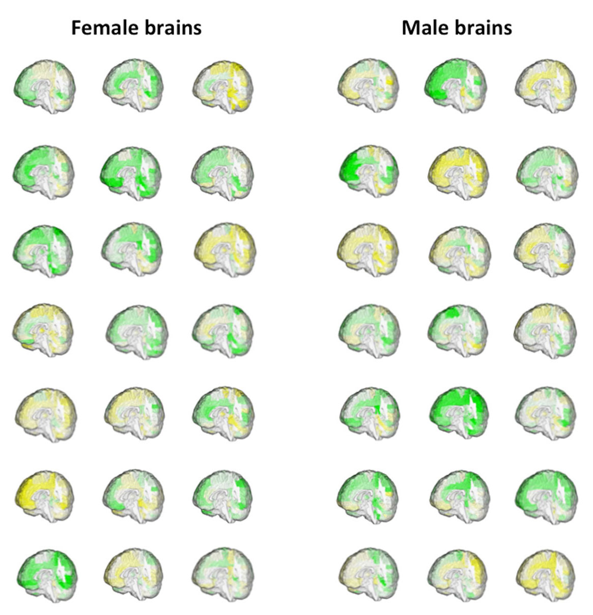 BrainSex