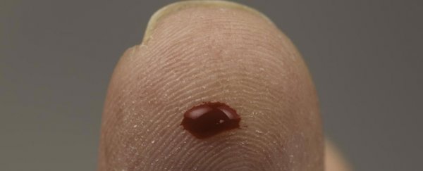New test can identify cancer from a single drop of blood with 96% accuracy