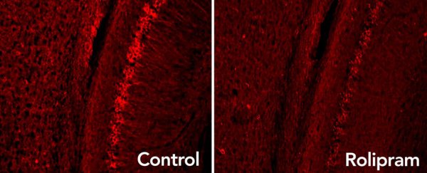 Drug that boosts the brain's 'garbage disposal' slows Alzheimer's in mice
