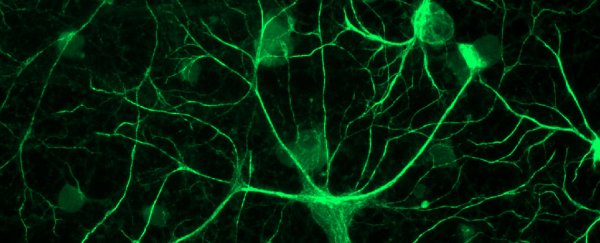 Brain cells we thought were just fillers might actually be the key to our body clocks