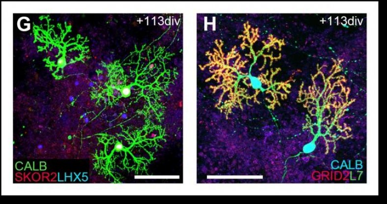 Scientists Have Grown Functioning Cerebellum-Like Brain Tissue in