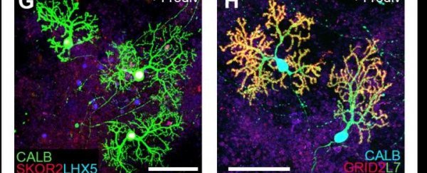 Scientists have grown functioning cerebellum-like brain tissue in the lab