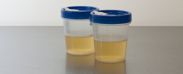 This new urine-based fuel cell puts your liquid waste to good use