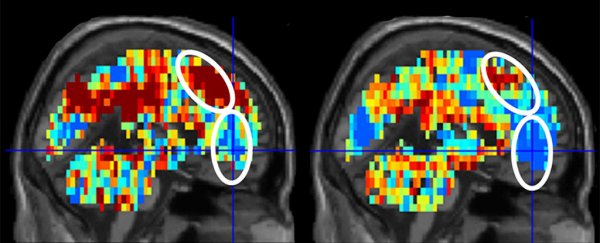 New AI could help us avert tragedy by identifying people with suicidal thoughts