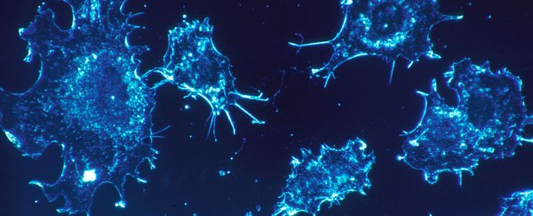 Two-thirds of cancer mutations are random and unavoidable, scientists claim