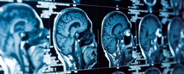 Why Doctors Are Fighting Depression by Targeting the Brain's Wiring