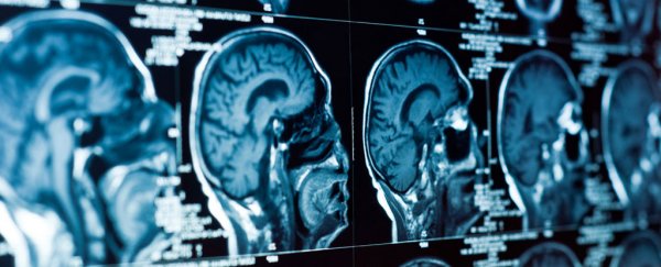 Scientists say they've identified the physical source of depression in the brain