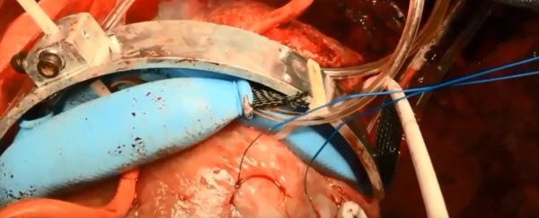 This amazing heart-squeezing robot keeps blood pumping in damaged organs