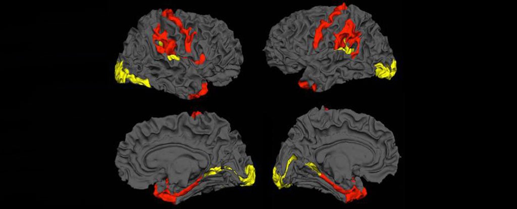 N.I.H.: Many Patients with Brain Injury Get No Follow-Up 