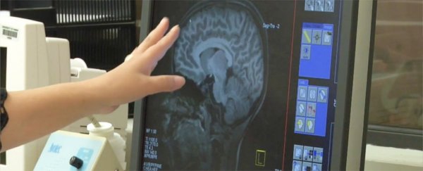 Alzheimer's could start affecting brain development from as young as 3