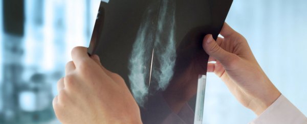 Largest-ever analysis of breast cancer genomes could lead to personalised treatments
