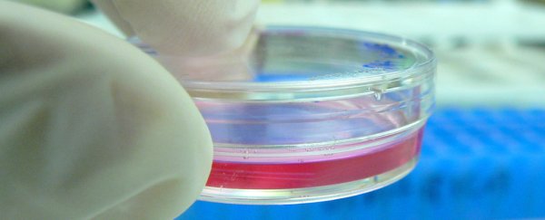 Big news: Australian High Court rules that the BRCA1 gene can't be patented