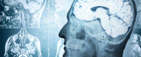 Scientists find evidence of 'anti-memories', and it could change our understanding of neuroscience