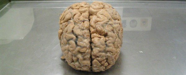 Scientists are 3D-printing tiny human brains